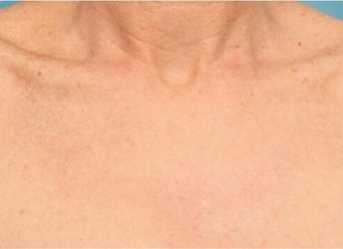 Пигмент после