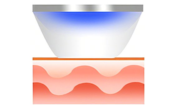 Картридж с микроиглами обеспечивает идеальный контакт с кожей.
