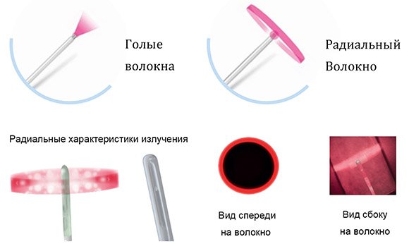 Оптические волокна Endolift Micro выпускаются в двух вариантах: без оболочки и с радиальным креплением.